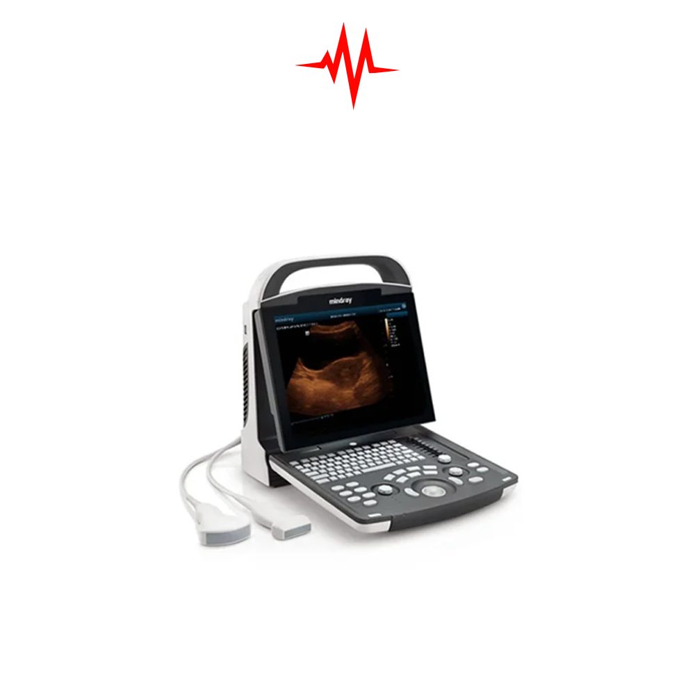 Precision Chison ECO-1 Portable Ultrasound